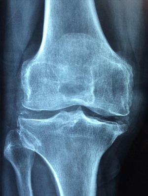 Keeping Your Bones Happy
